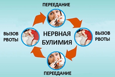 Лечение булимии в Петровске-Забайкальском